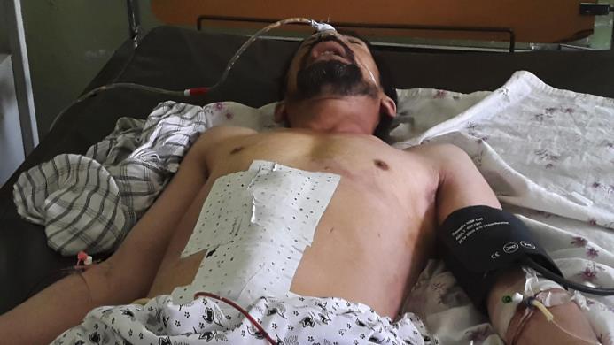 Un hombre afgano permanece hospitalizado tras resultar herido en un tiroteo, en el hospital Pul-e-Khomri de Baghlan, Afganistán, hoy, 27 de julio de 2015. Al menos 22 personas murieron y otras nueve resultaron heridas en la fiesta de una boda. 