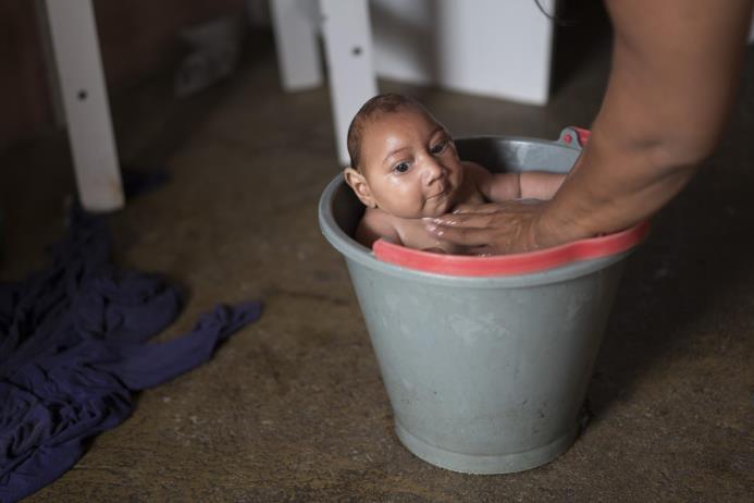Una señora baña a su hijo que sufre microcefalia, enfermedad que está relacionada con el virus del Zika, transmitido por picadura de mosquito. 