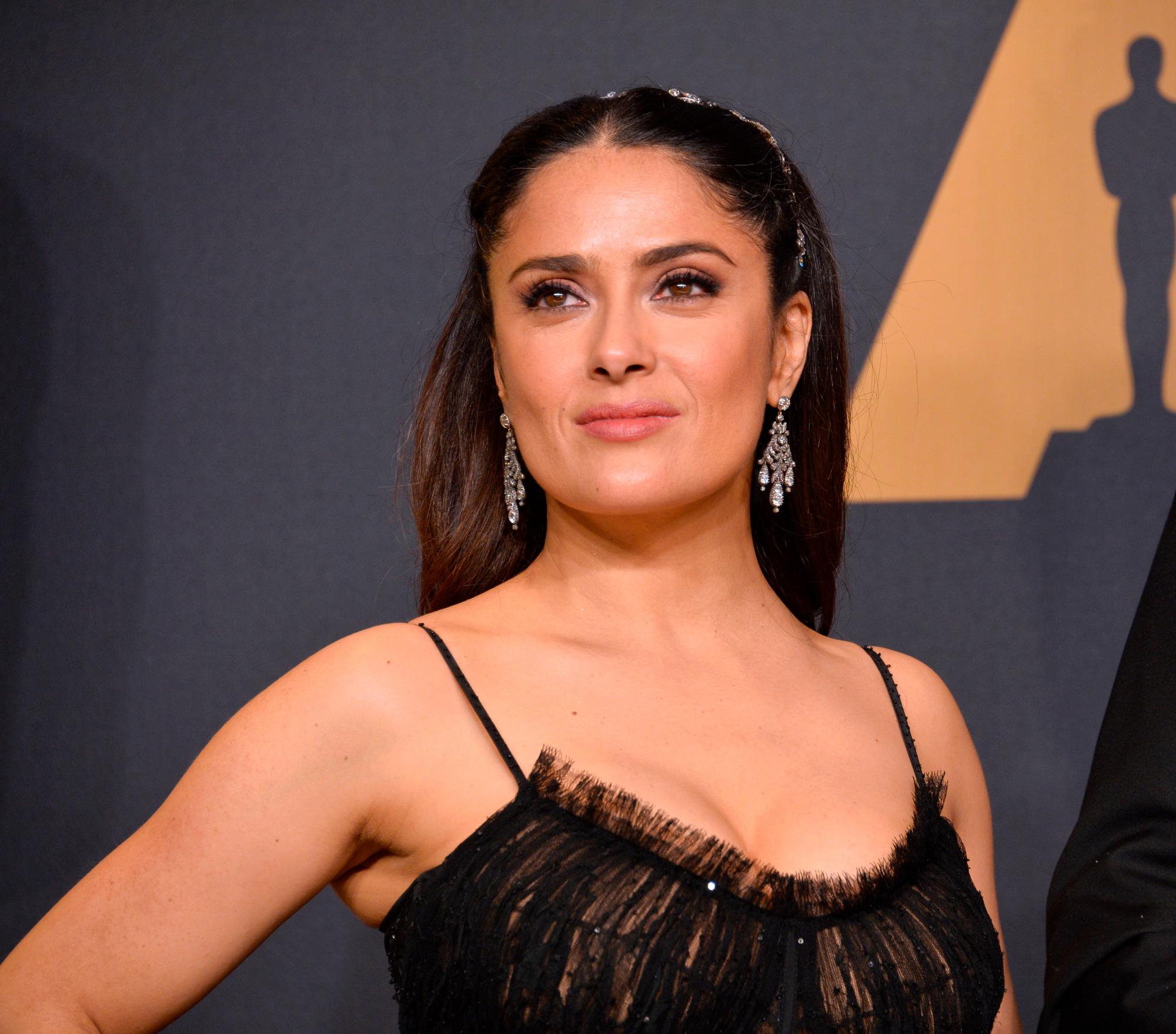 From the age of 12 to over 50, Salma Hayek suffers from this complicated disorder
