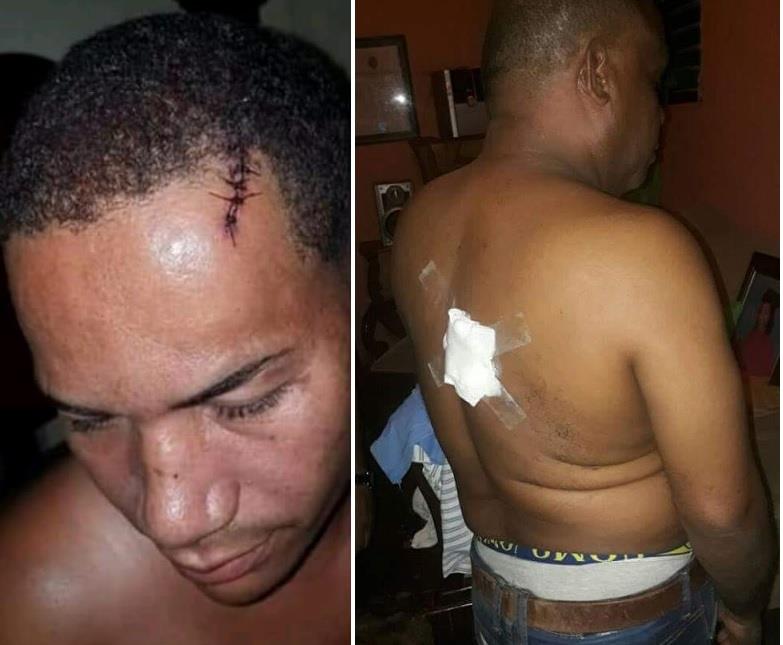 Dos heridos en pleito entre danilistas y un seguidor de Leonel 