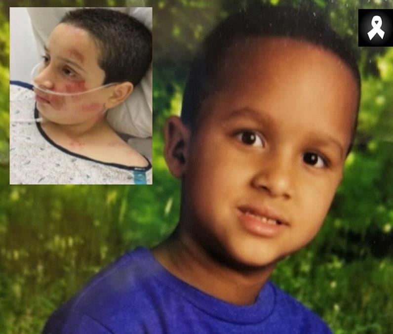 Niño de origen dominicano muere  al caer de balcón de vivienda en Nueva Jersey 