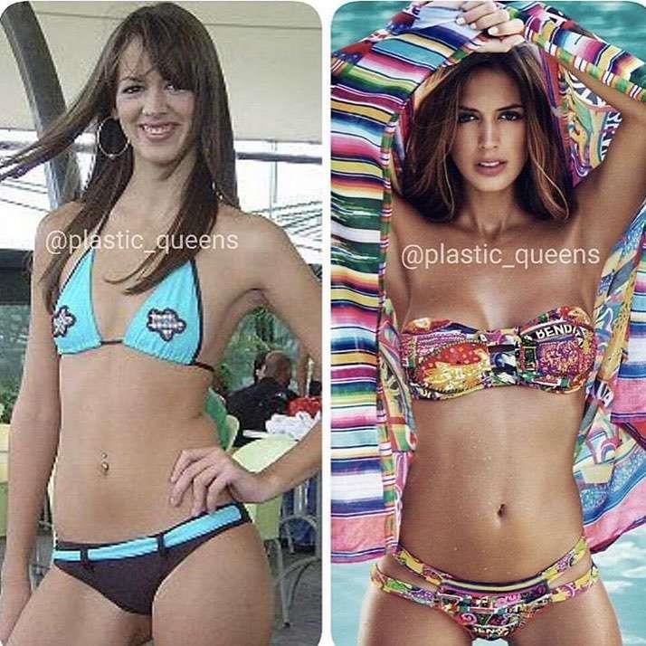 Lo que hacen las cirugías, mire aquí a Shannon de Lima, la novia de Canelo, antes y después